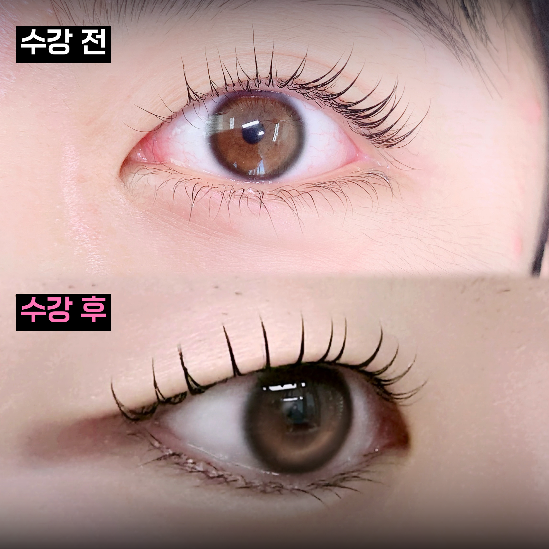 수강생 Before & After 1